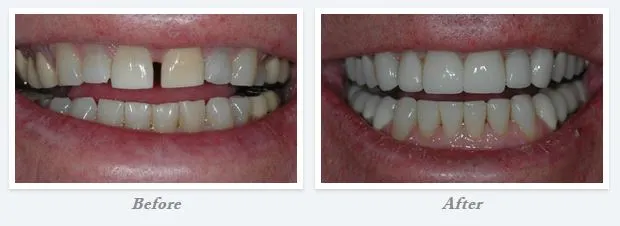 Smile Gallery Scottsdale AZ, Grayhawk Prosthodontics P.C.